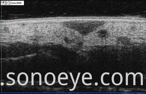 image for Ophthalmic A/B Scanner